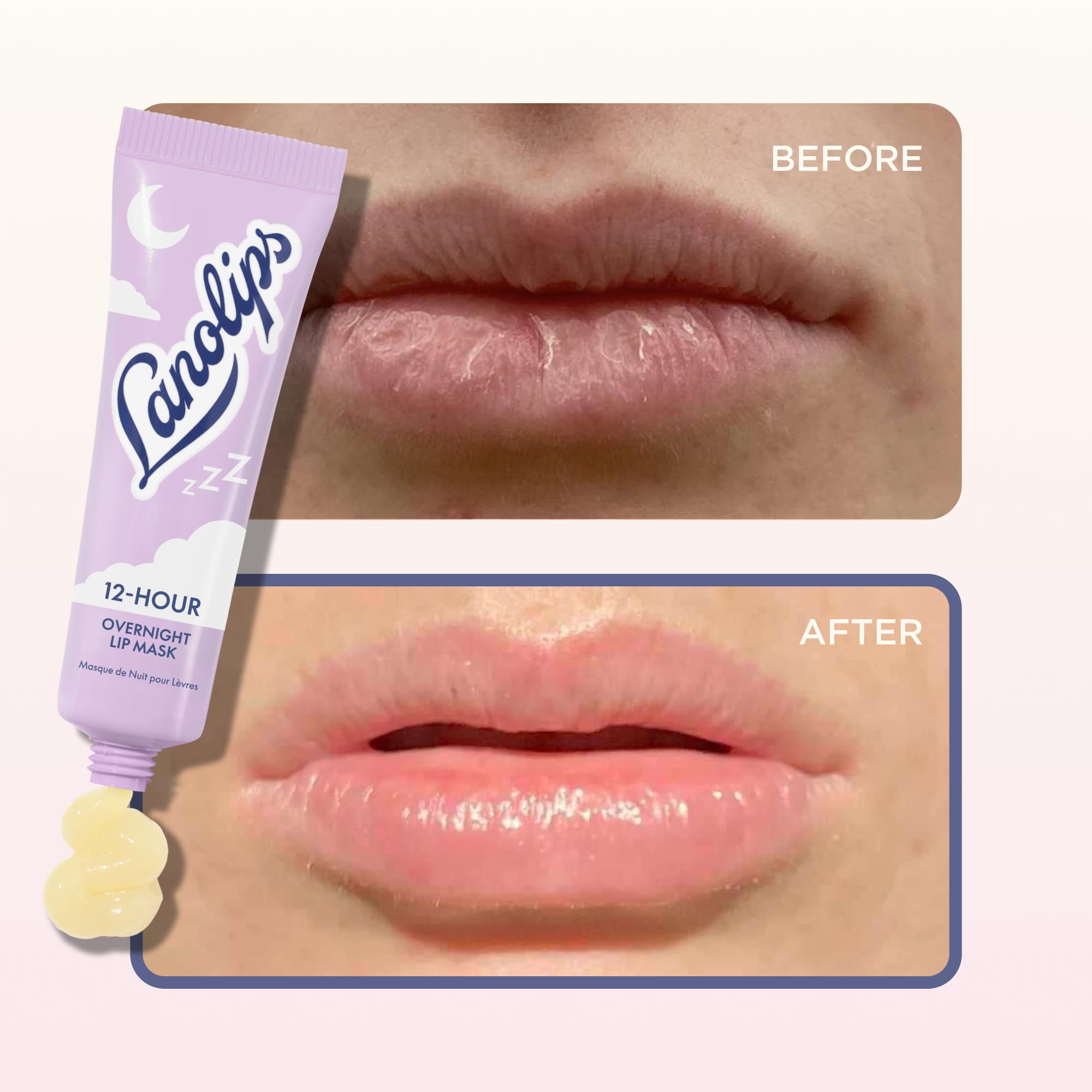 Lanolips soin nocturne lèvres — réveil en douceur et lèvres plus confortables.
