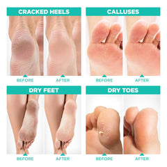 Lavinso Mélange botanique Exfoliant Pieds – solution naturelle pour rugosités.