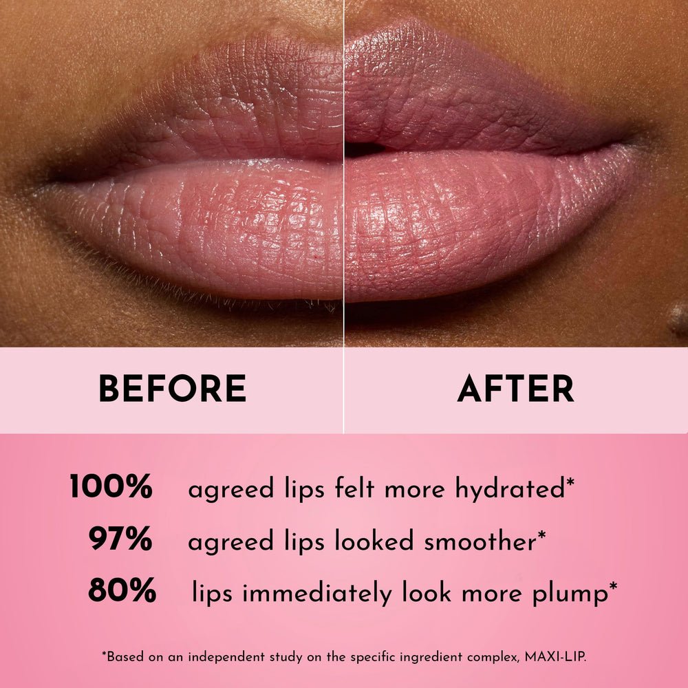Lawless Forget the Filler zoom-levres-plumpes: effet repulpant visible et durable.