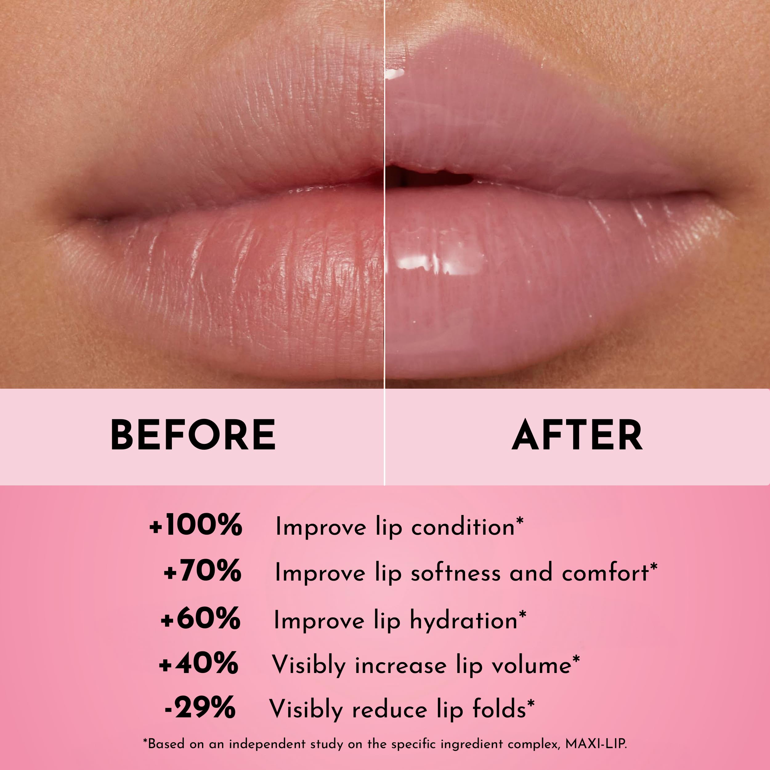 Lawless Forget The Filler Lip Plumper – Avant/après lèvres plus lisses et pulpeuses.