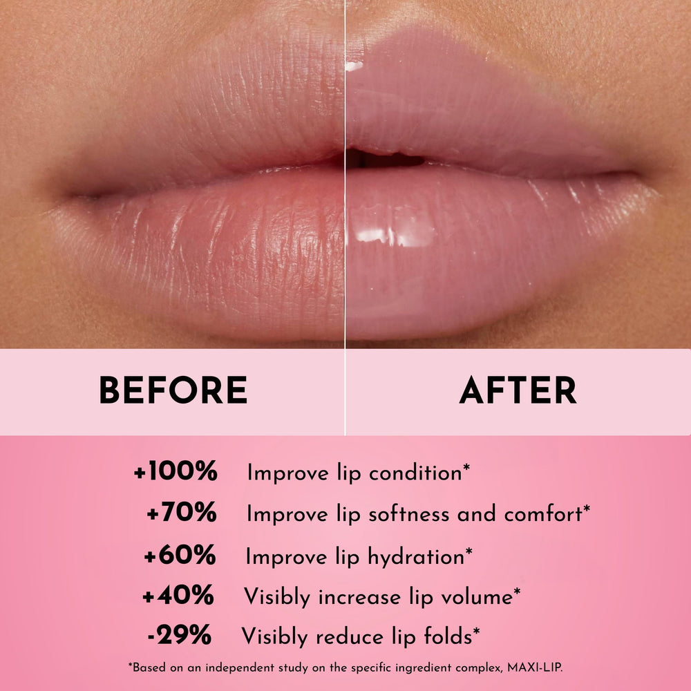 Lawless Forget The Filler Lip Plumper – Avant/après lèvres plus lisses et pulpeuses.
