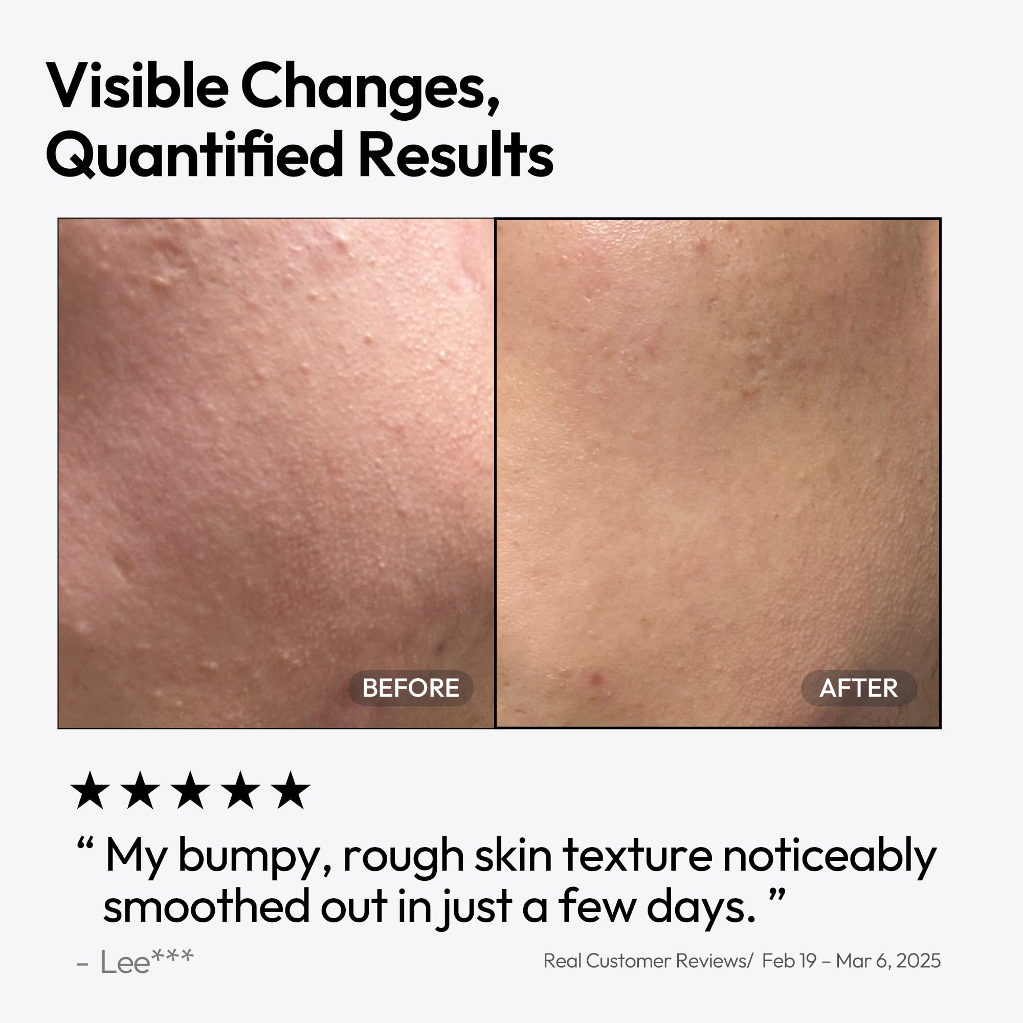 Pénétration sans résidu gras du LayerLab Triple Retinoid pour la routine.