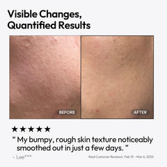 Pénétration sans résidu gras du LayerLab Triple Retinoid pour la routine.