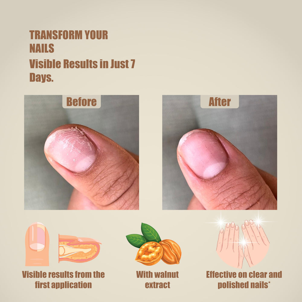 LAZONAIL brillance naturelle des ongles-vernis, sans modifier la couleur du vernis.