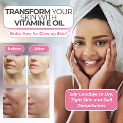 Leven Rose huile vitamine E pour ongles et cuticules, répare les zones sèches.