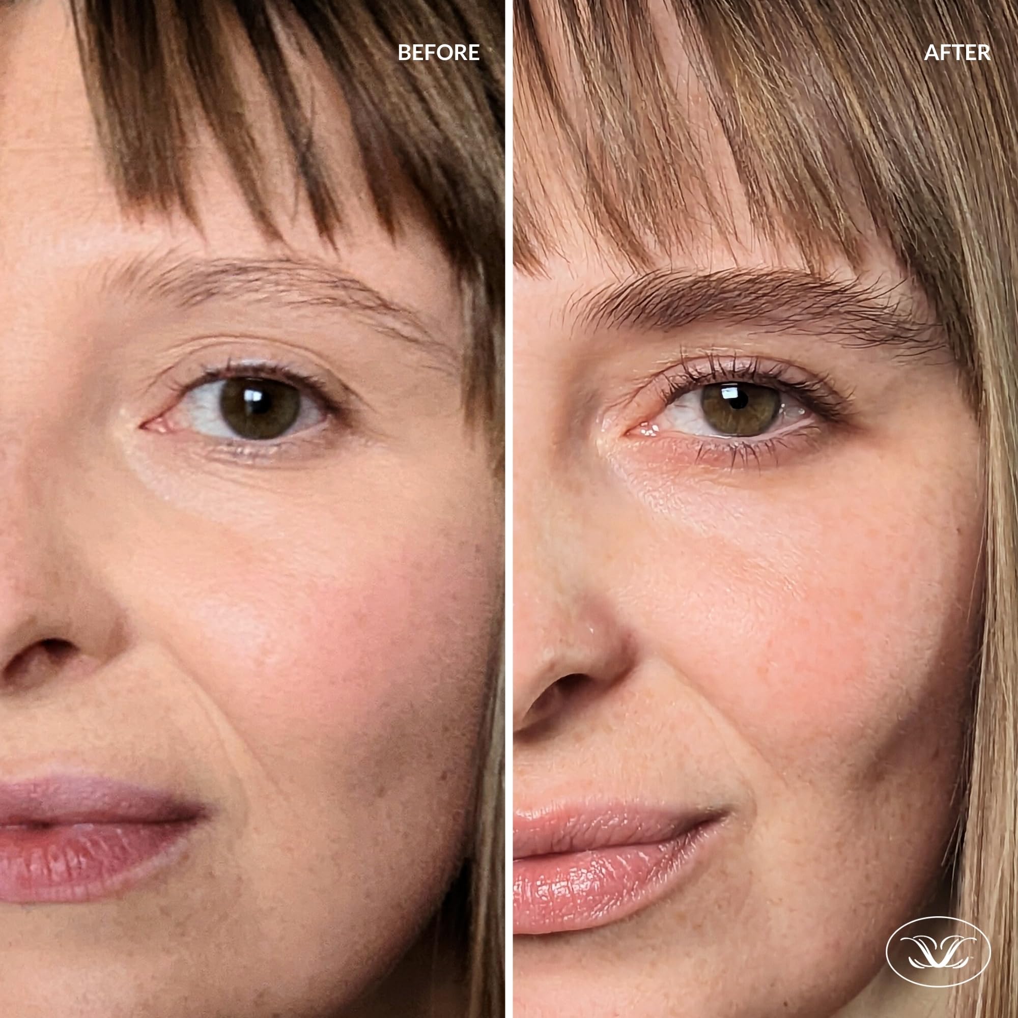 Librow formule douce pour peau sensible; convient aux cheveux clairsemés.