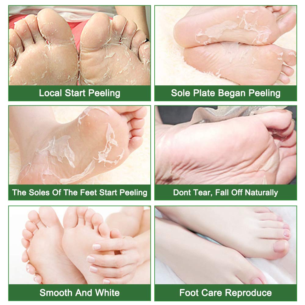 Aperçu des étapes d’utilisation du masque peeling Liefiet pour les pieds