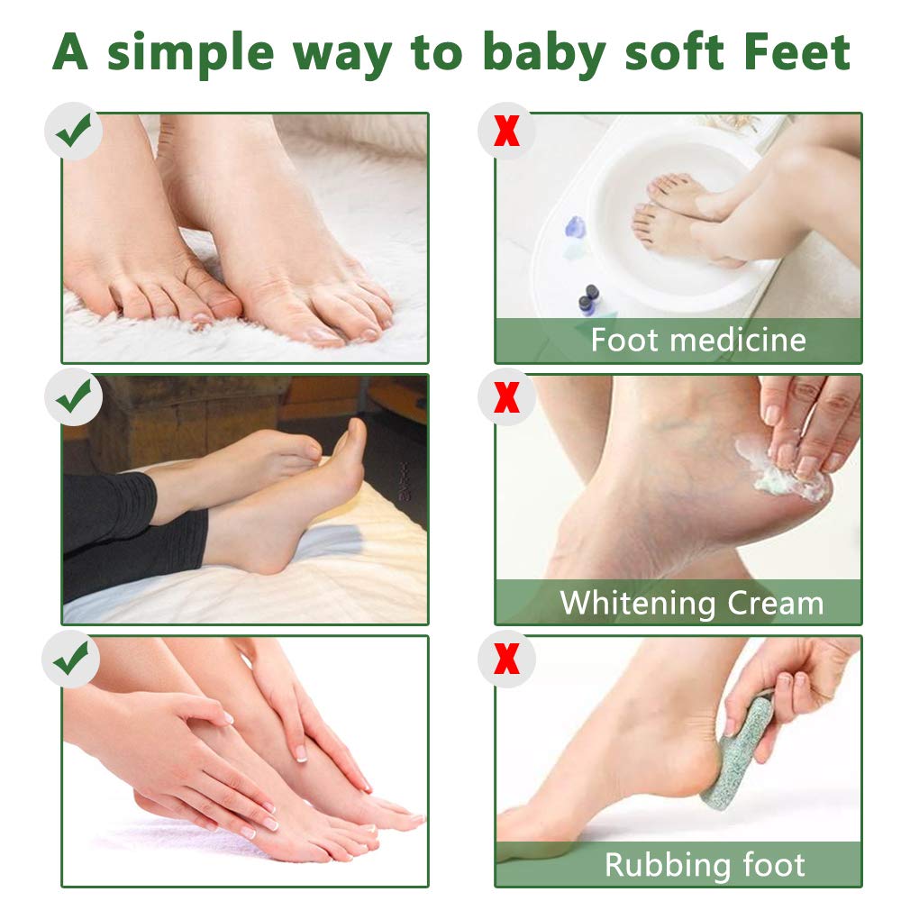Désquamation des peaux mortes avec Liefiet masque peeling pieds
