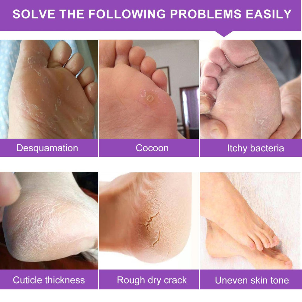 Chaussettes Liefiet sur les pieds pendant le soin pour effet spa à domicile.