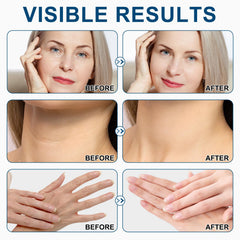 Décolleté avec Liefiet retinol, améliore l’élasticité et la fermeté