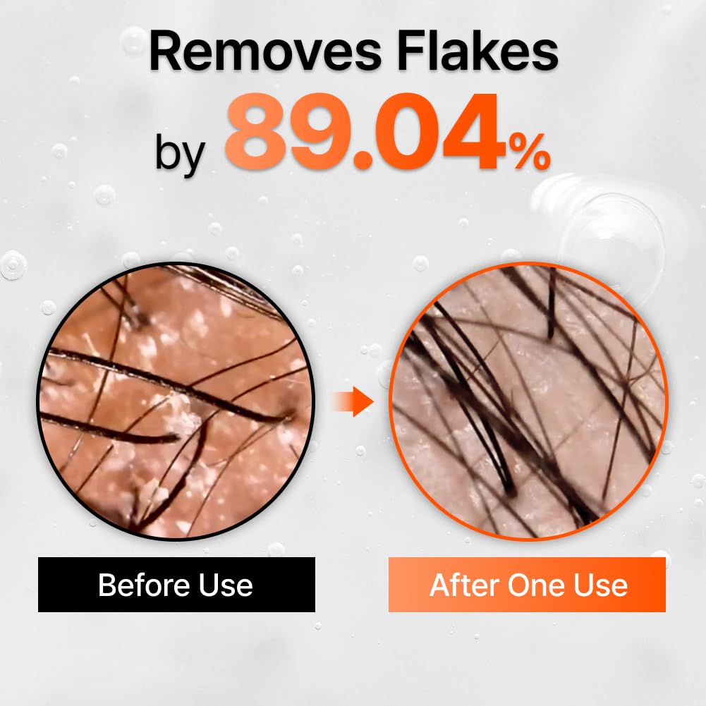 LilyEve GrowTurn formule sans parfum artificiel, adaptée aux cuirs sensibles et secs.