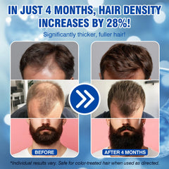 Lipend Minoxidil application sur les cheveux ciblant les zones à traiter.