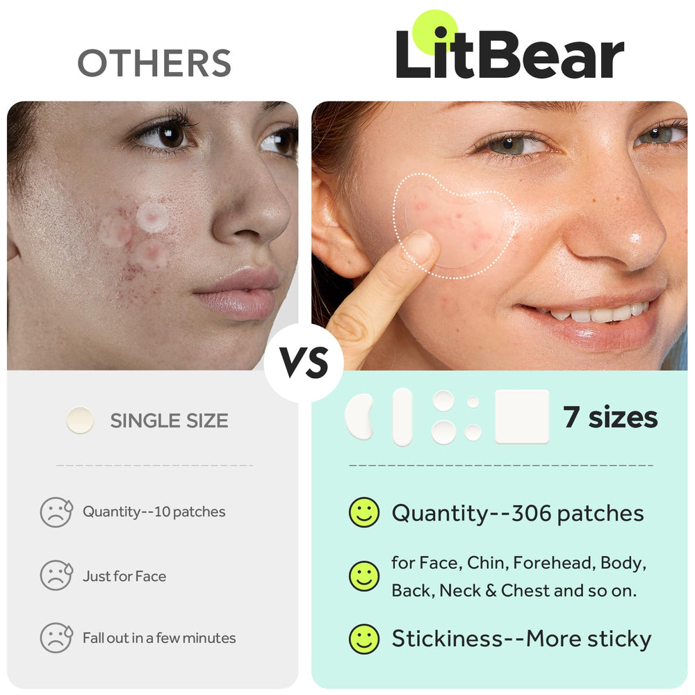 LitBear patch hydrocolloïde 60x60mm XL sur le dos, traitement des grosses zones.