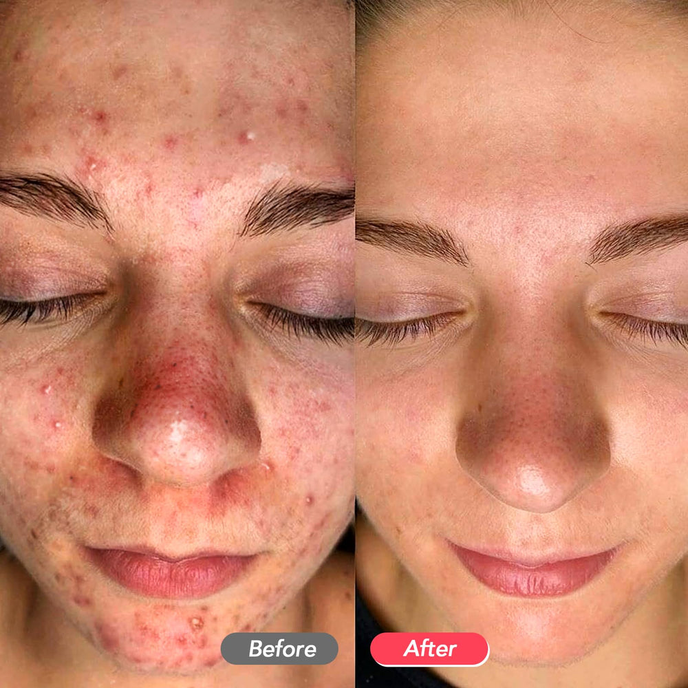 Utilisation à domicile pour un soin du visage pratique avec LitBear.