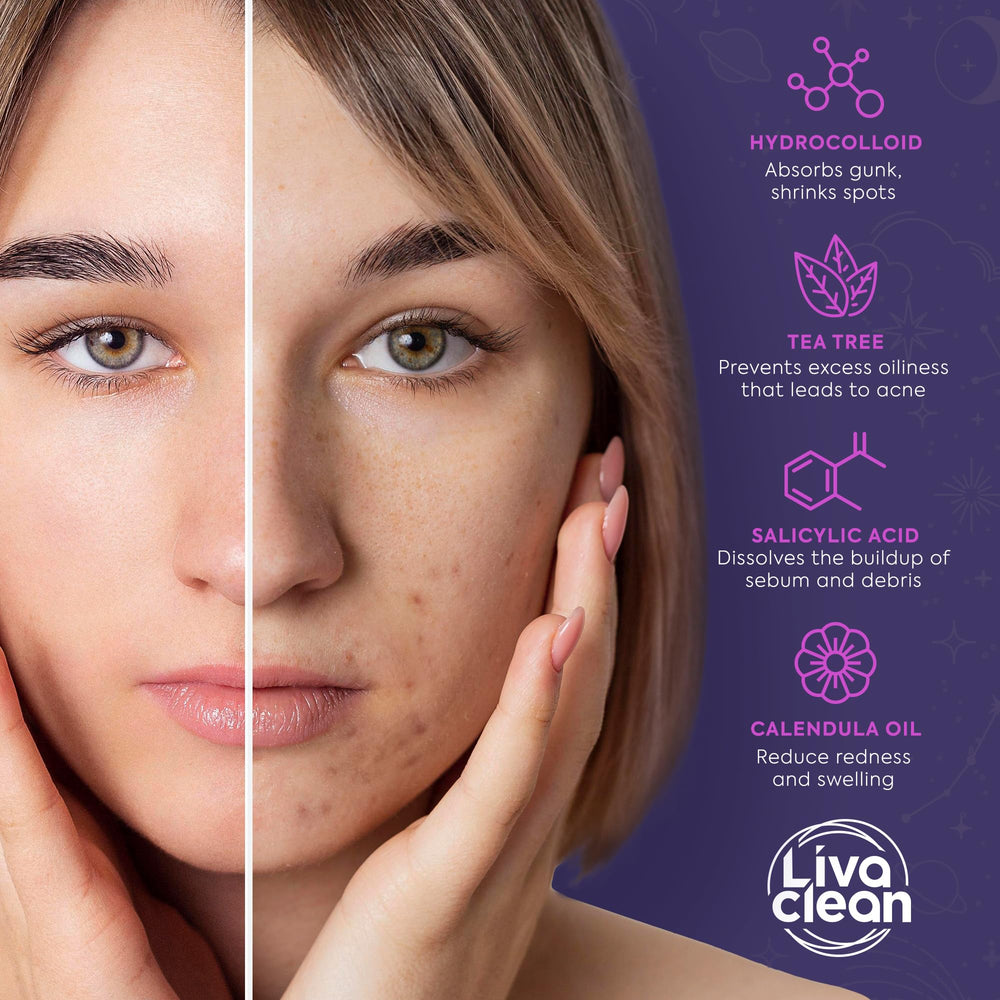 Patch étoile rose translucide Livaclean sur le visage, idéal contre les boutons.