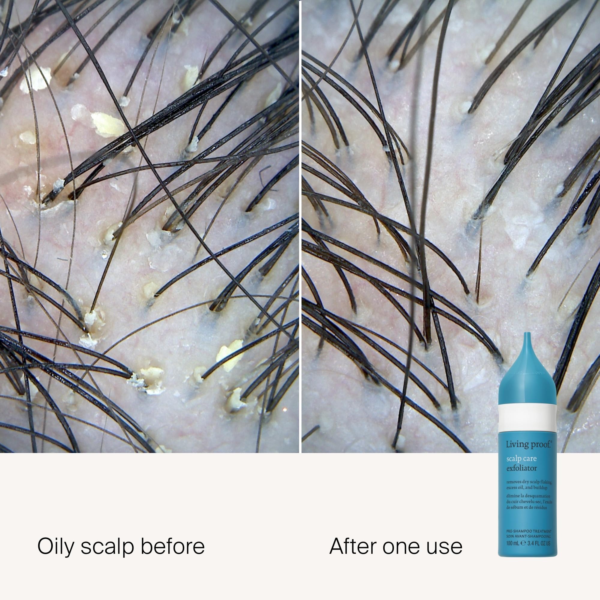 Living Proof Exfoliant Cuir Chevelu – embout applicateur direct pour une application précise