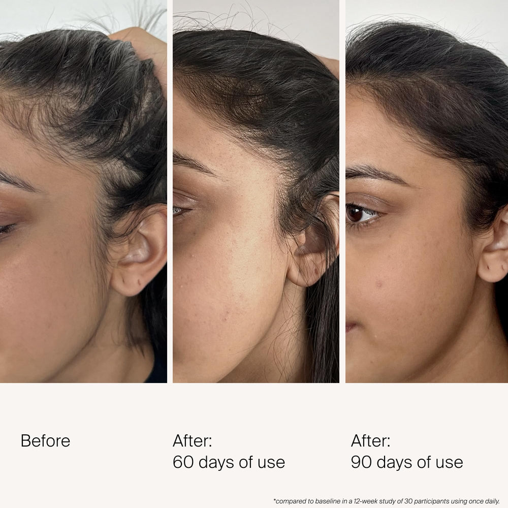 Living Proof Density Serum — flacon prêt à l’application quotidienne sur le cuir chevelu.