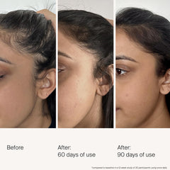 Living Proof Density Serum — flacon prêt à l’application quotidienne sur le cuir chevelu.