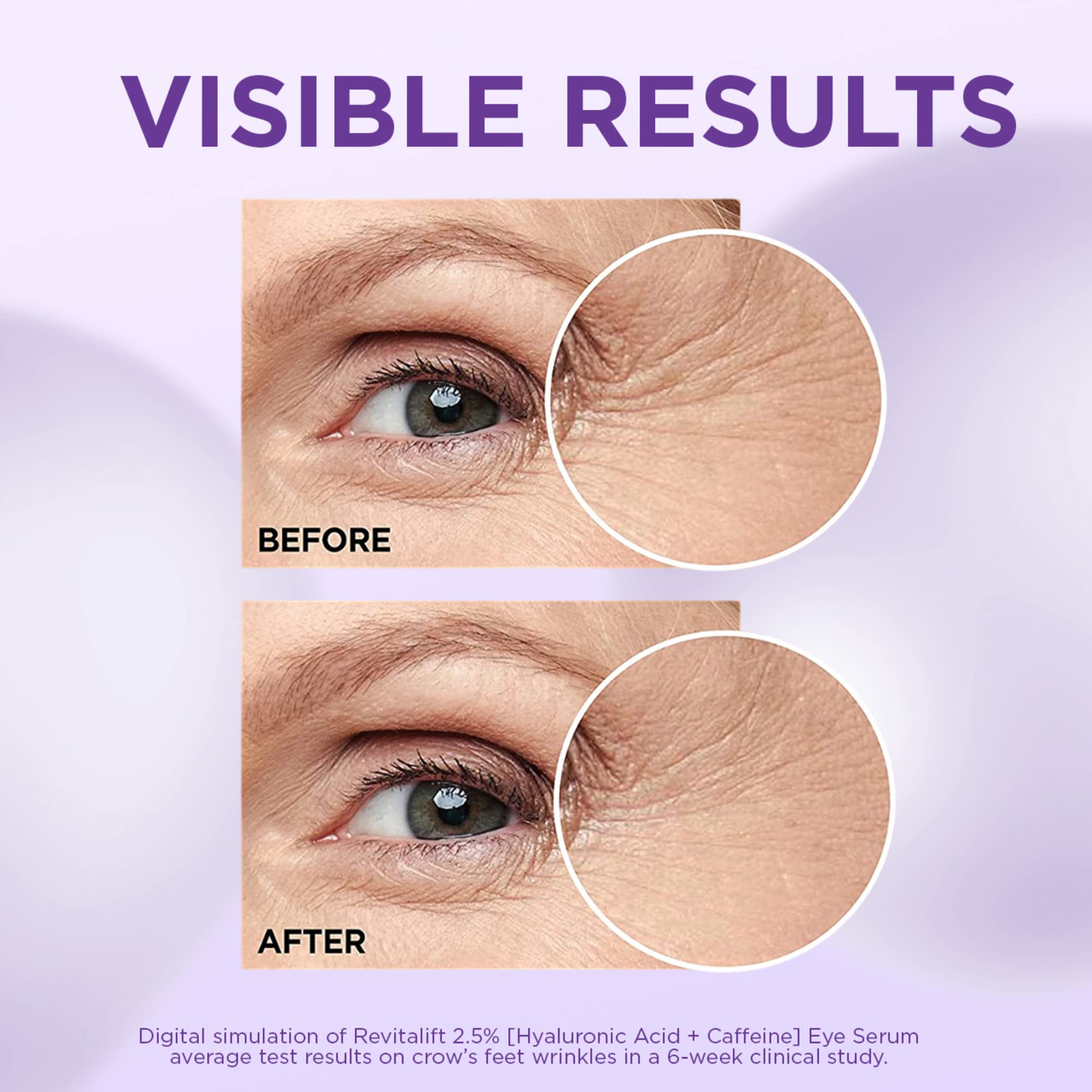L’Oréal Paris Revitalift Derm Intensives – formule sans parfum adaptée aux peaux sensibles autour des yeux.