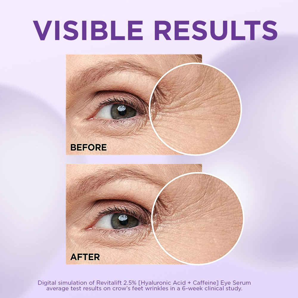 L’Oréal Paris Revitalift Derm Intensives – formule sans parfum adaptée aux peaux sensibles autour des yeux.