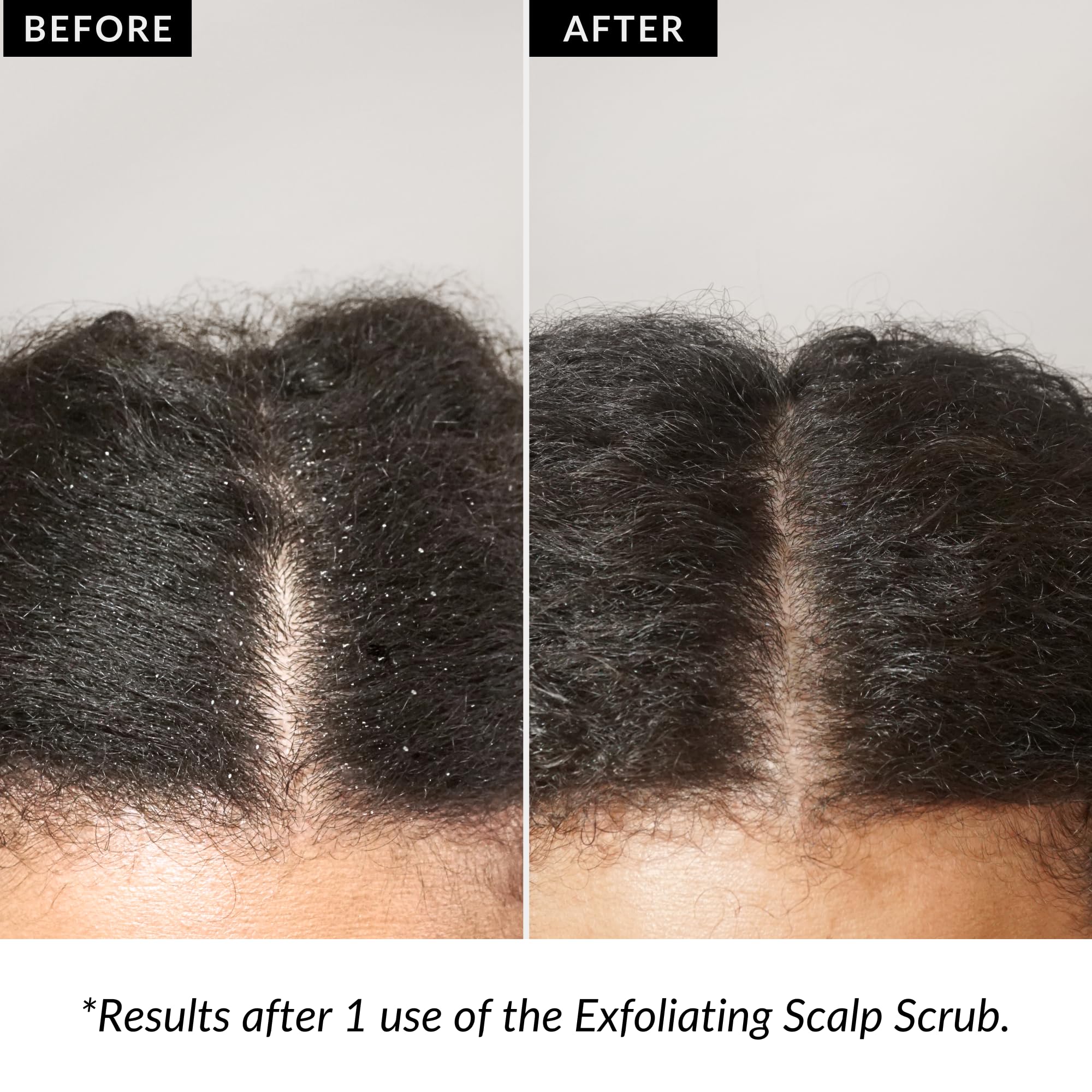 Love Ur Curls Exfoliant: pré-shampoing prêt à l’emploi pour préparer le lavage