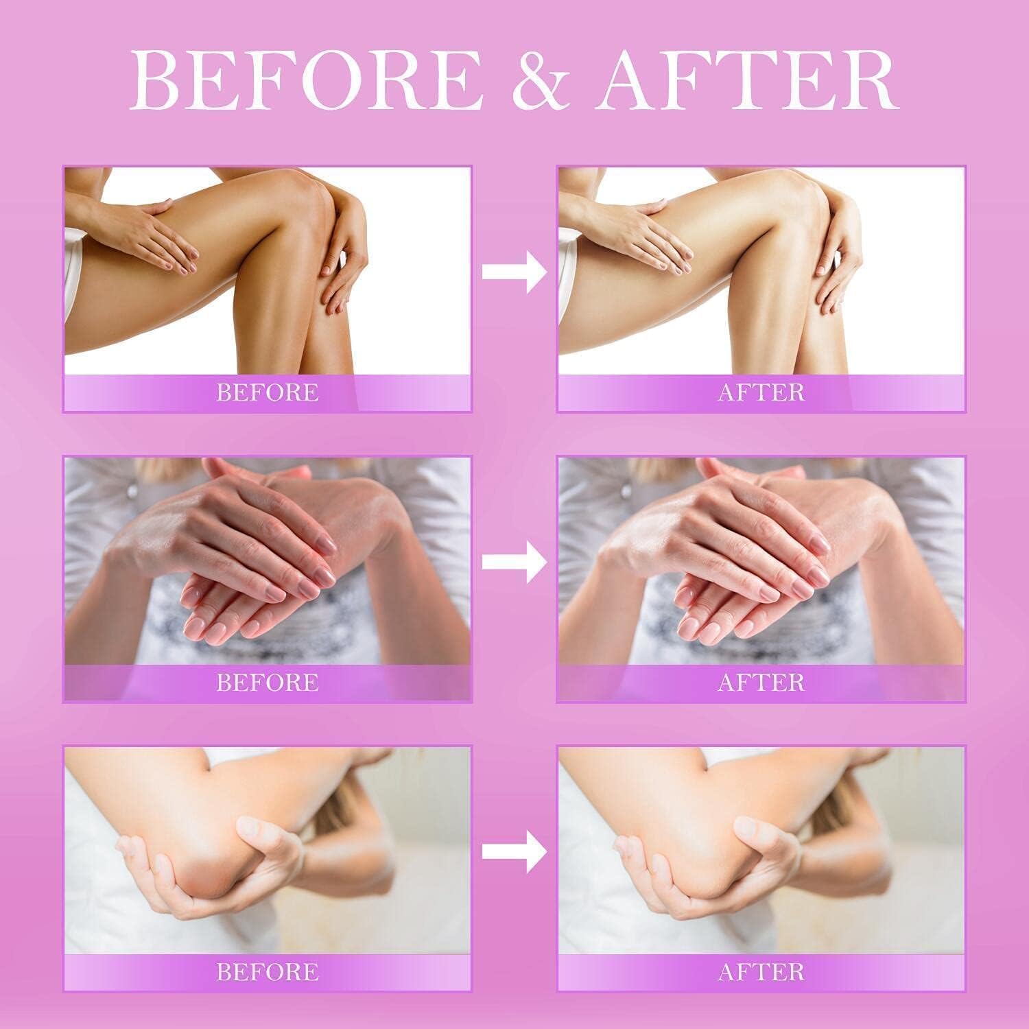 LOVOOD Crème Correctrice Coudes, hydratation en profondeur et teint uniforme.