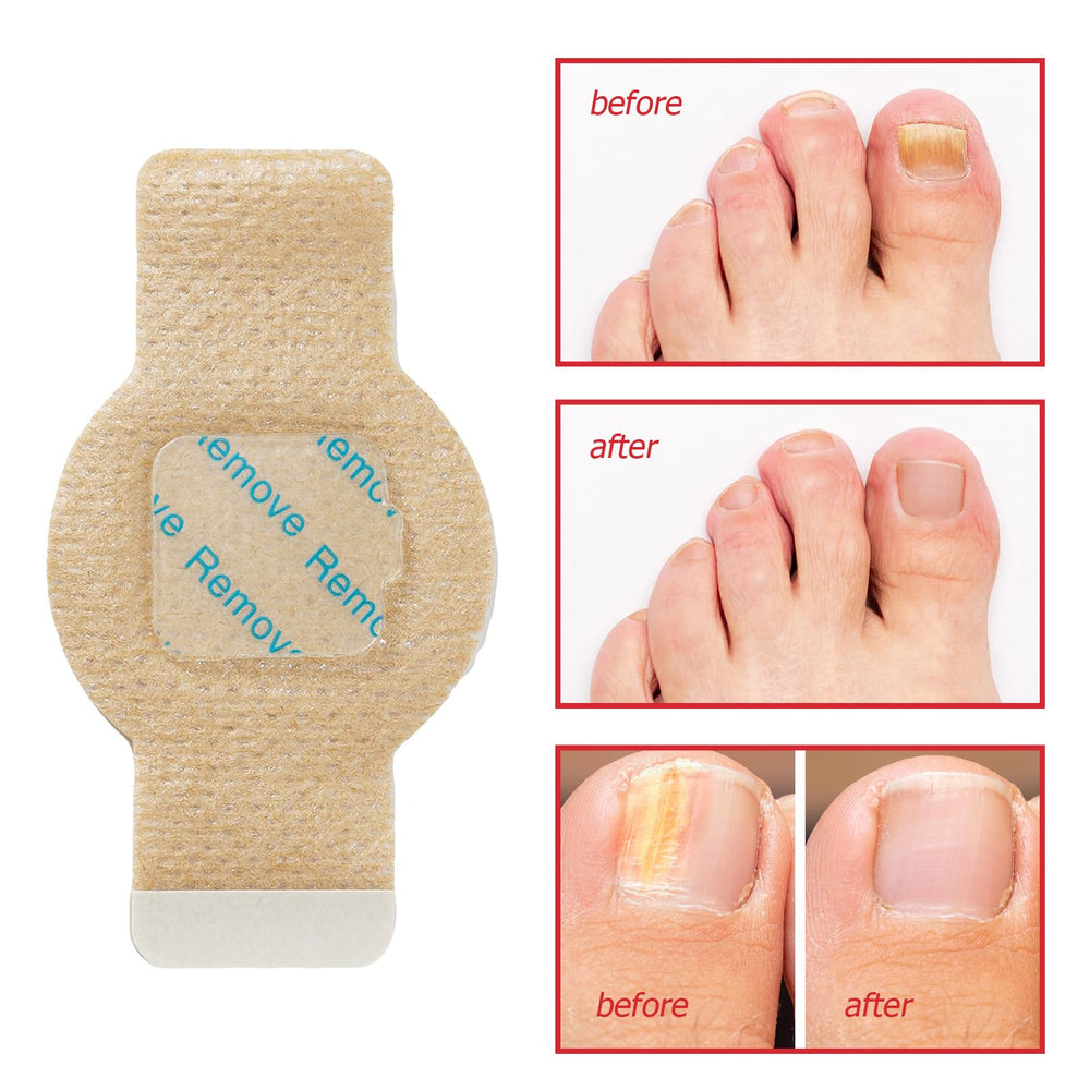 LTQXGT patch application step shows easy-to-use covering for nails