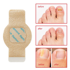 LTQXGT patch application step shows easy-to-use covering for nails