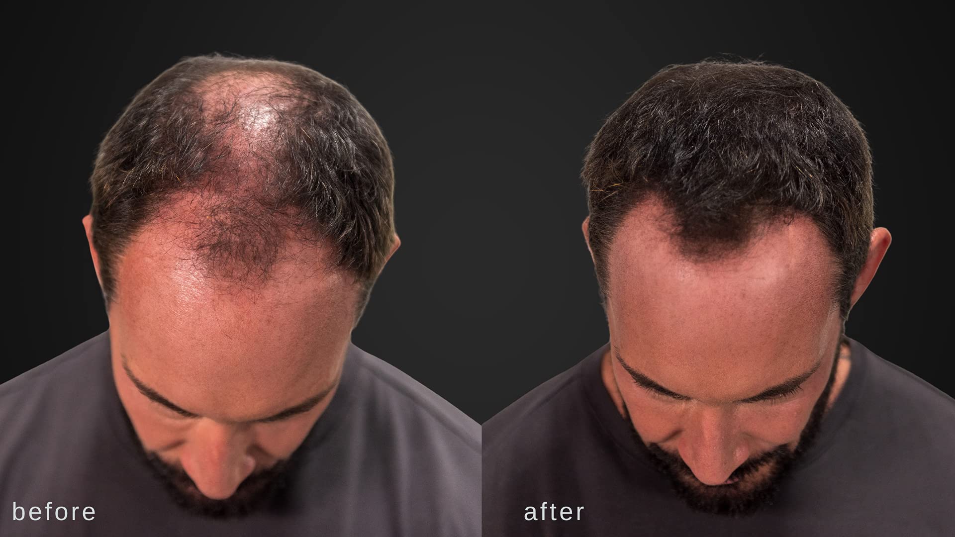 LUXE Professional Fibres capillaires: flacon 25 g prêt pour une longue utilisation.