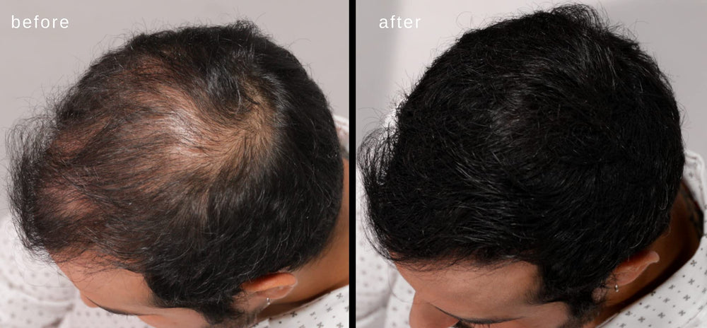 LUXE Professional Fibres capillaires: ne tache pas les vêtements même mouillés.