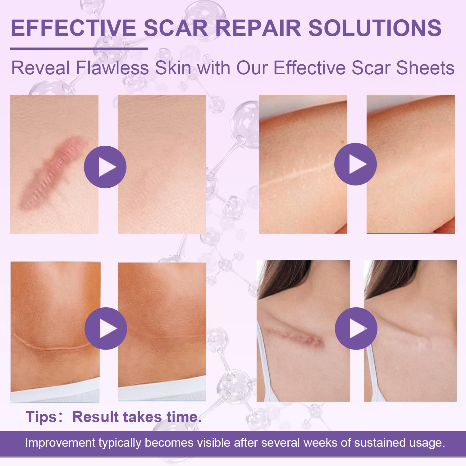 Luxefus bande scar silicone application faciale: usage confortable sur le visage