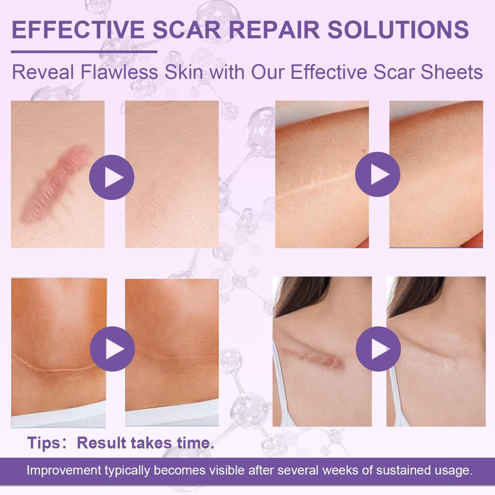 Luxefus bande scar silicone application faciale: usage confortable sur le visage