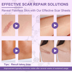 Luxefus bande scar silicone application faciale: usage confortable sur le visage
