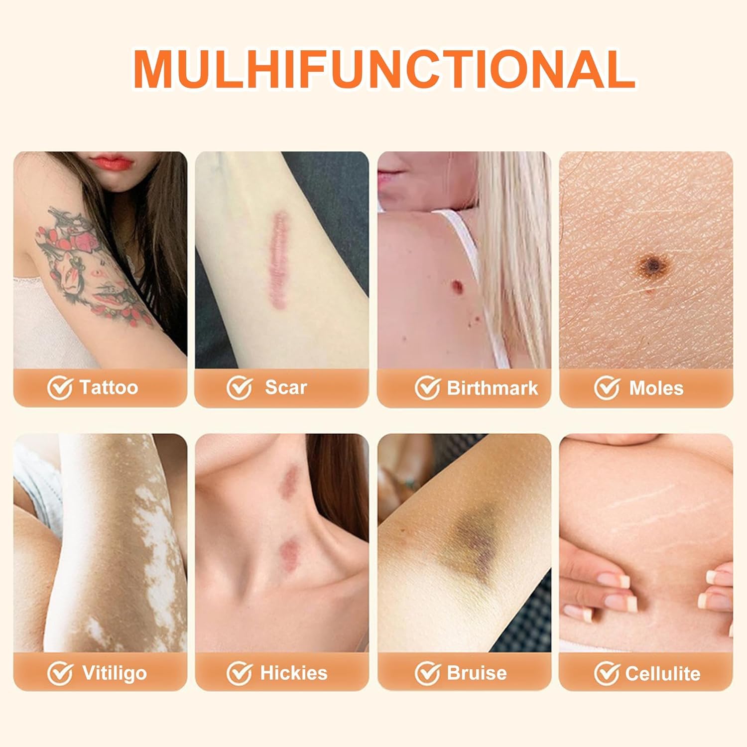 Pansement-couverture tatouage Lvnwrip application sur bras et épaule, couvrance naturelle.