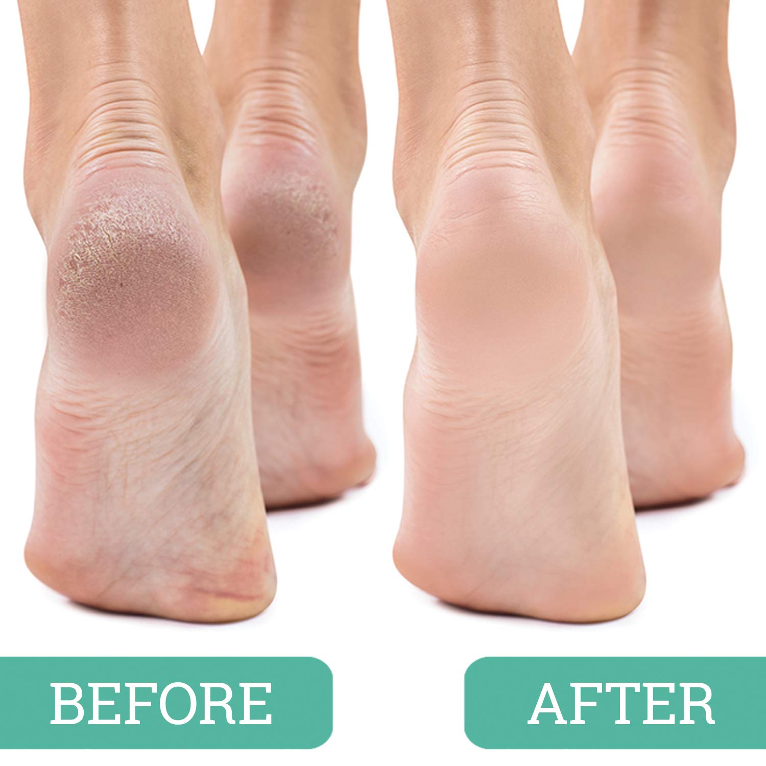 Utilisation en paume avec Maccibelle, maniabilité et confort pour les pieds.