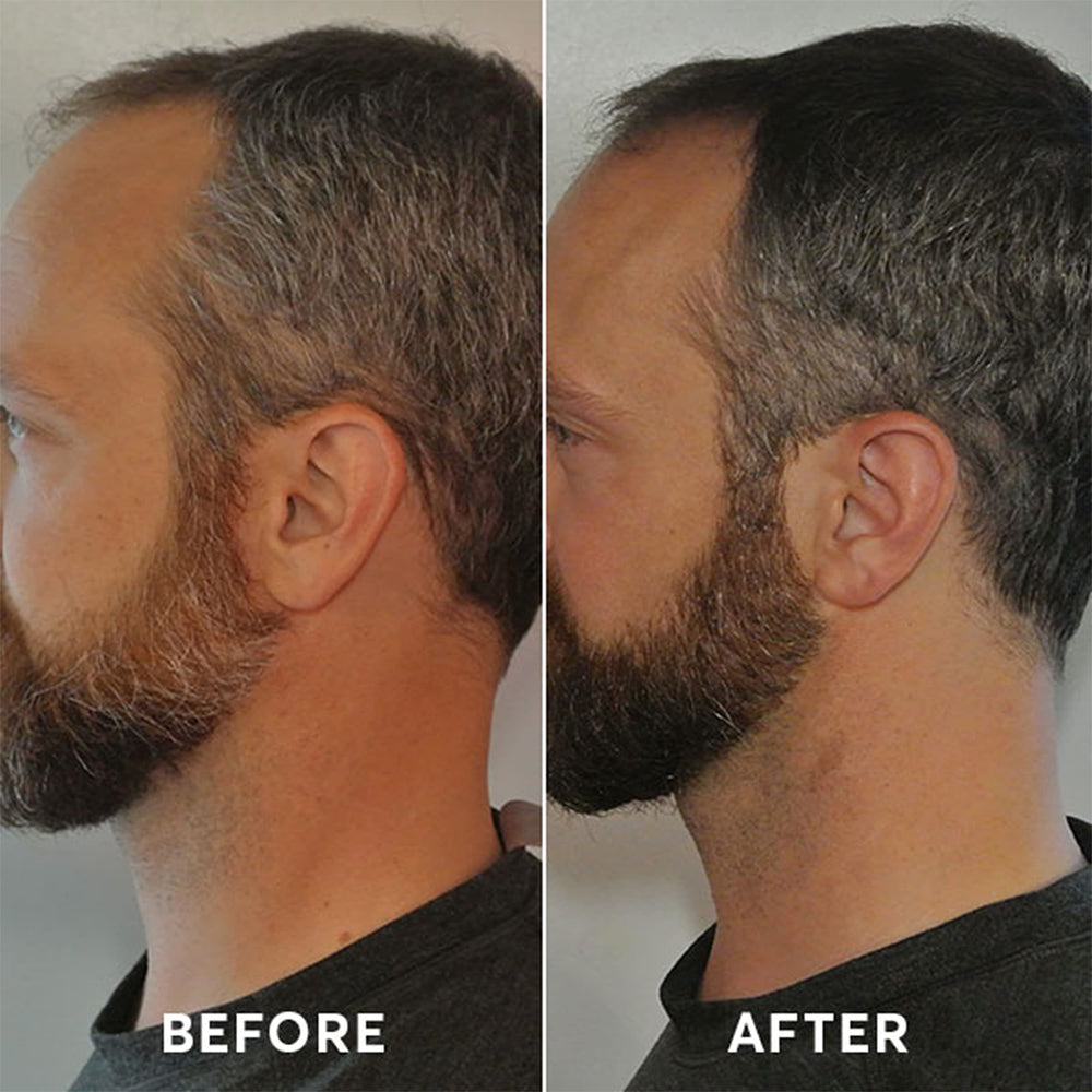 Madison Reed Mr. Homme – résultat avant/après sur cheveux et barbe, aspect naturel.