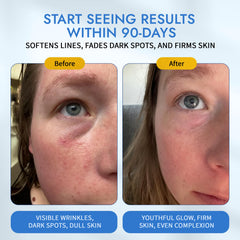 Ingrédients clés Moonlight: hyaluronique et céramides pour hydrater et protéger.