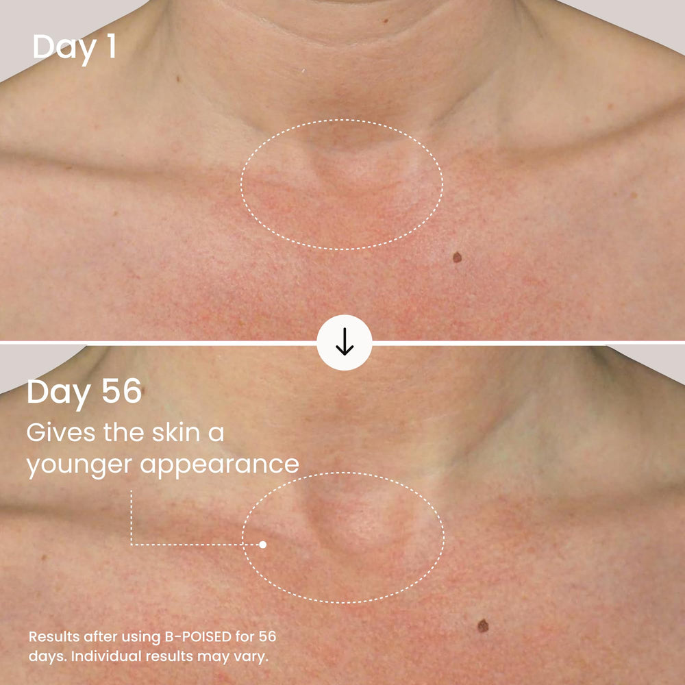 Maëlys B-POISED Crème Cou-Décolleté : routine matinale légère et efficace.