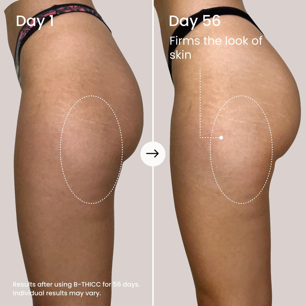 Maëlys B-THICC peau des fesses plus lisse et hydratée.