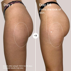 Maëlys B-THICC peau des fesses plus lisse et hydratée.