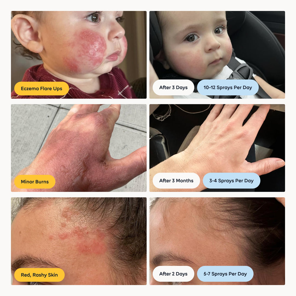 Magic Molecule Hypochloreux — nettoyant paupières doux pour une routine légère.