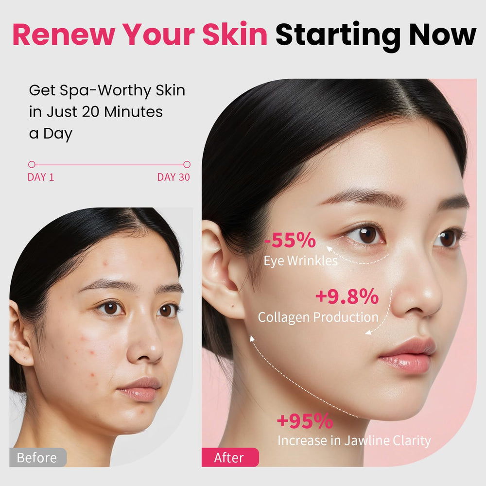 Magivol Face Lift Device utilise une lumière rouge LED pour stimuler la peau en douceur.