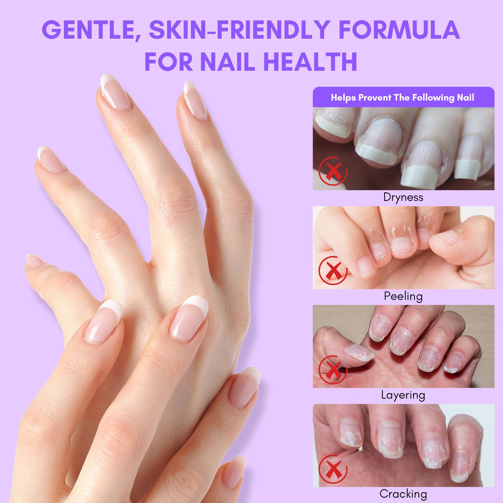 Makartt dissolvant rapide et sans odeur pour retirer facilement les ongles.