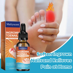 Maliyscent goutte ongle incarné en action sur l’orteil pour assouplir