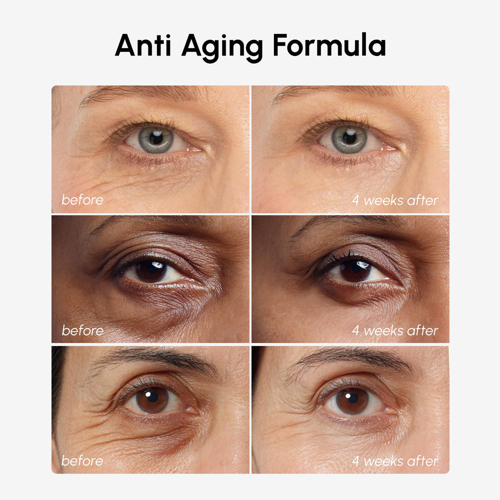 HYALURONIQUE et COLLAGÈNE – peau des contours plus lisse autour des yeux.