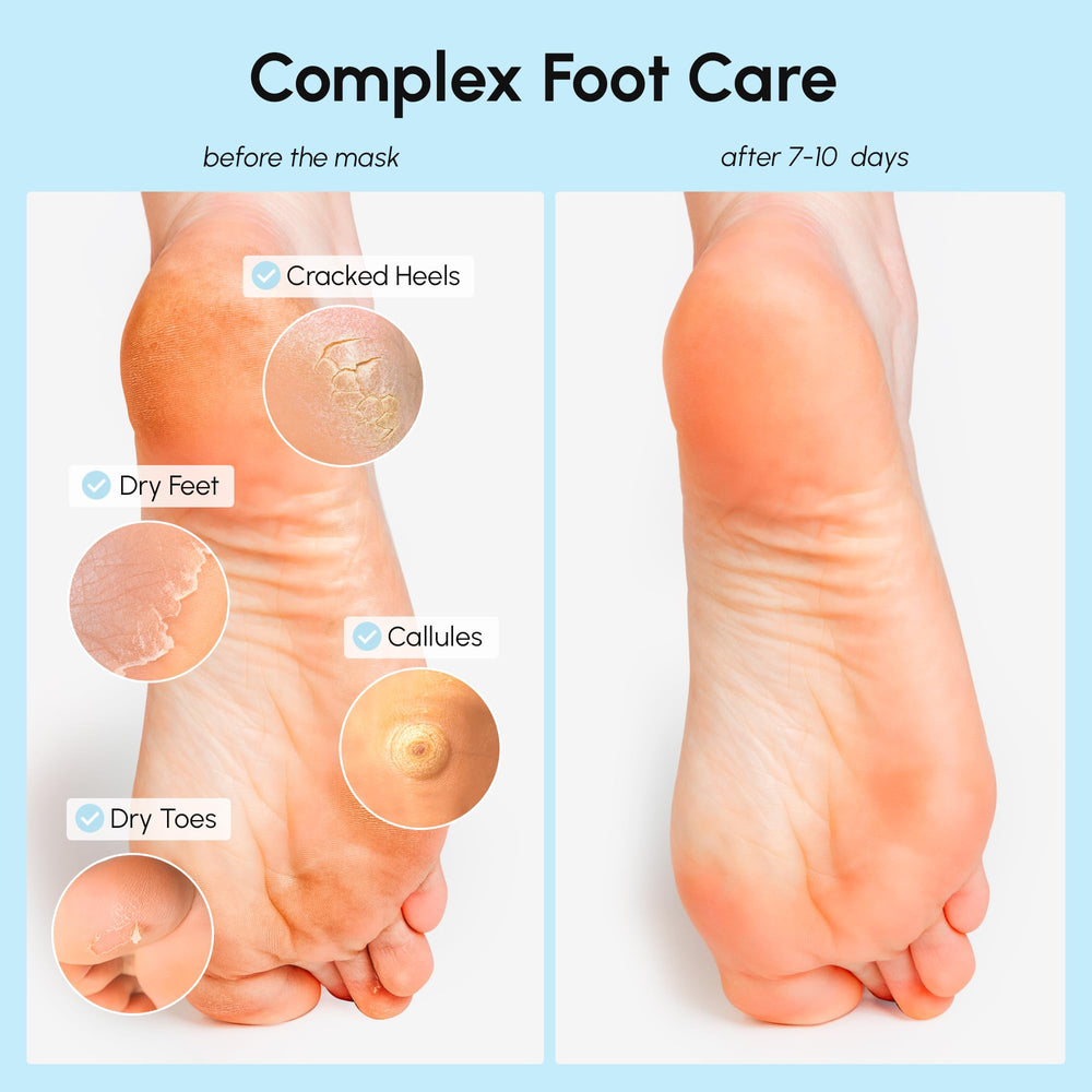 MAREE chaussettes hydratantes pour pieds offrent un confort durable.