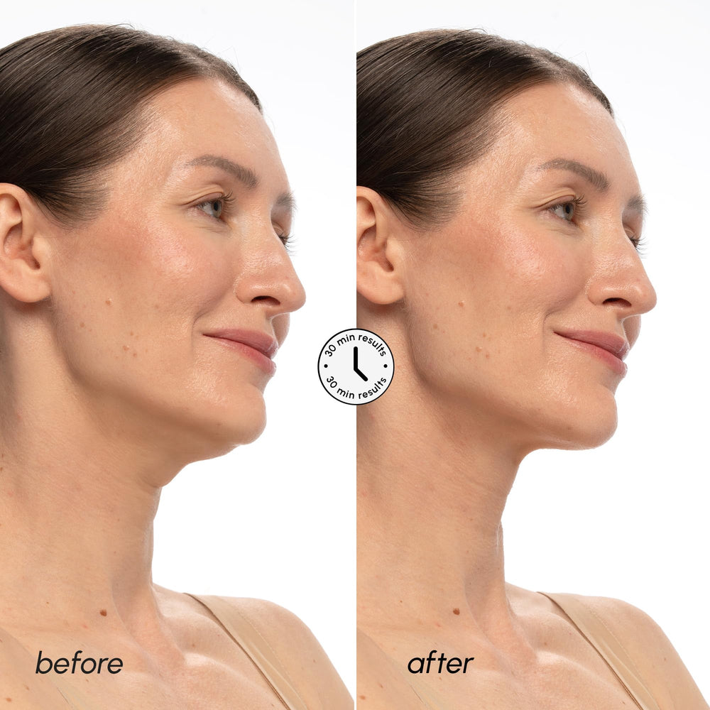 MAREE V Line Masque Hydratation Acide Hyaluronique nourrit et assainit la peau du cou.