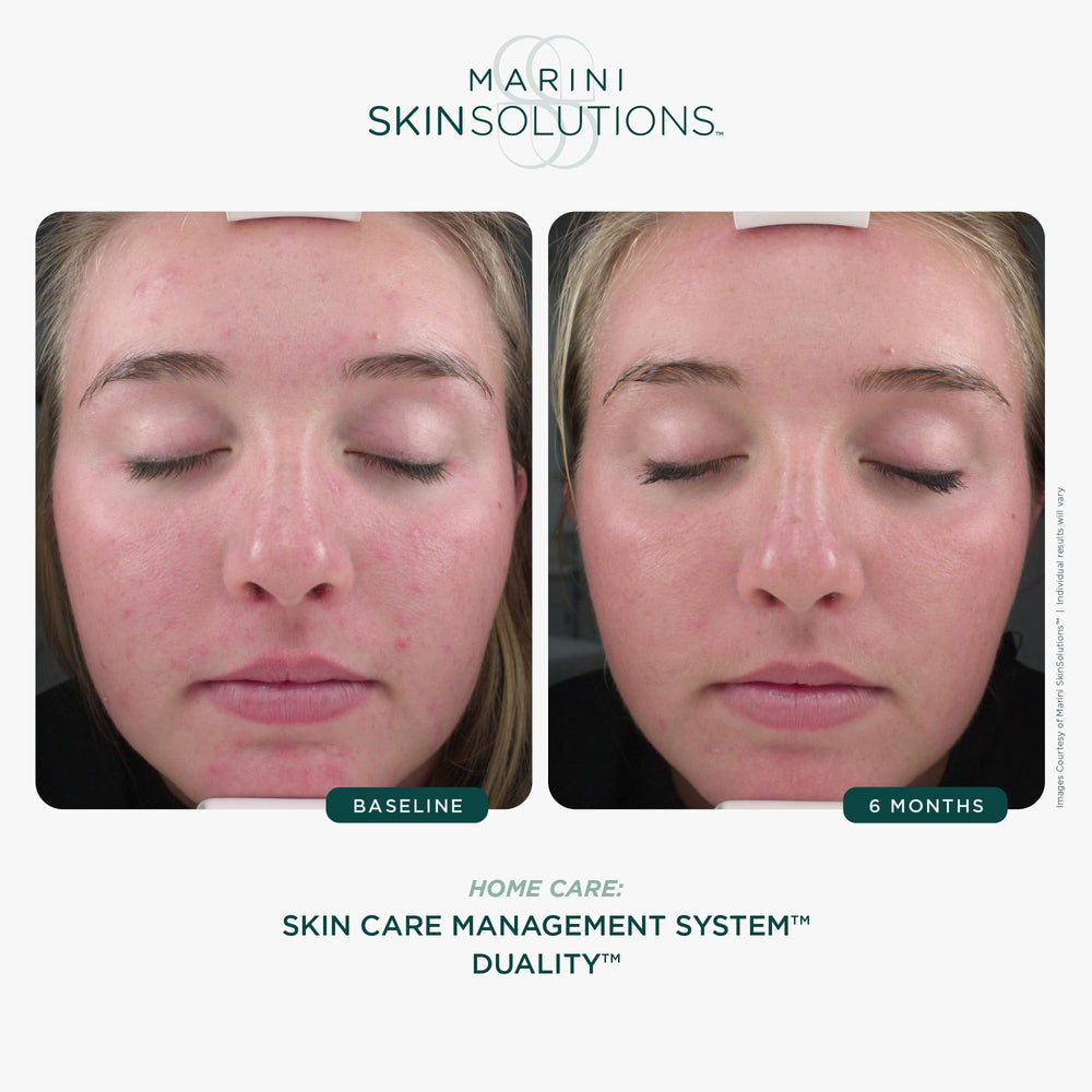 Marini SkinSolutions Dualité : système à deux chambres facilitant le mélange avant usage.
