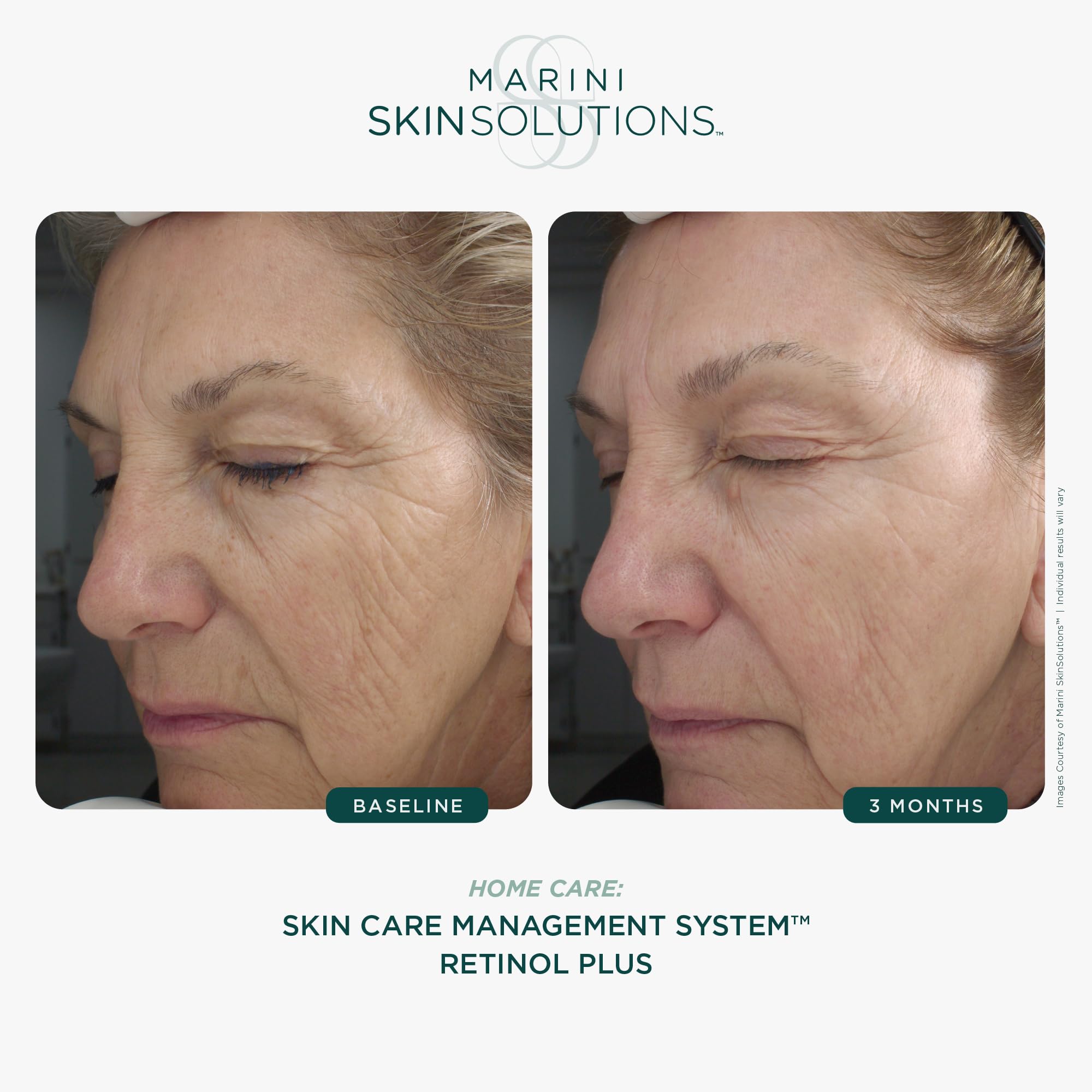 Marini SkinSolutions Retinol Plus crème-visage: texture lisse et hydratante