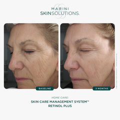 Marini SkinSolutions Retinol Plus crème-visage: texture lisse et hydratante